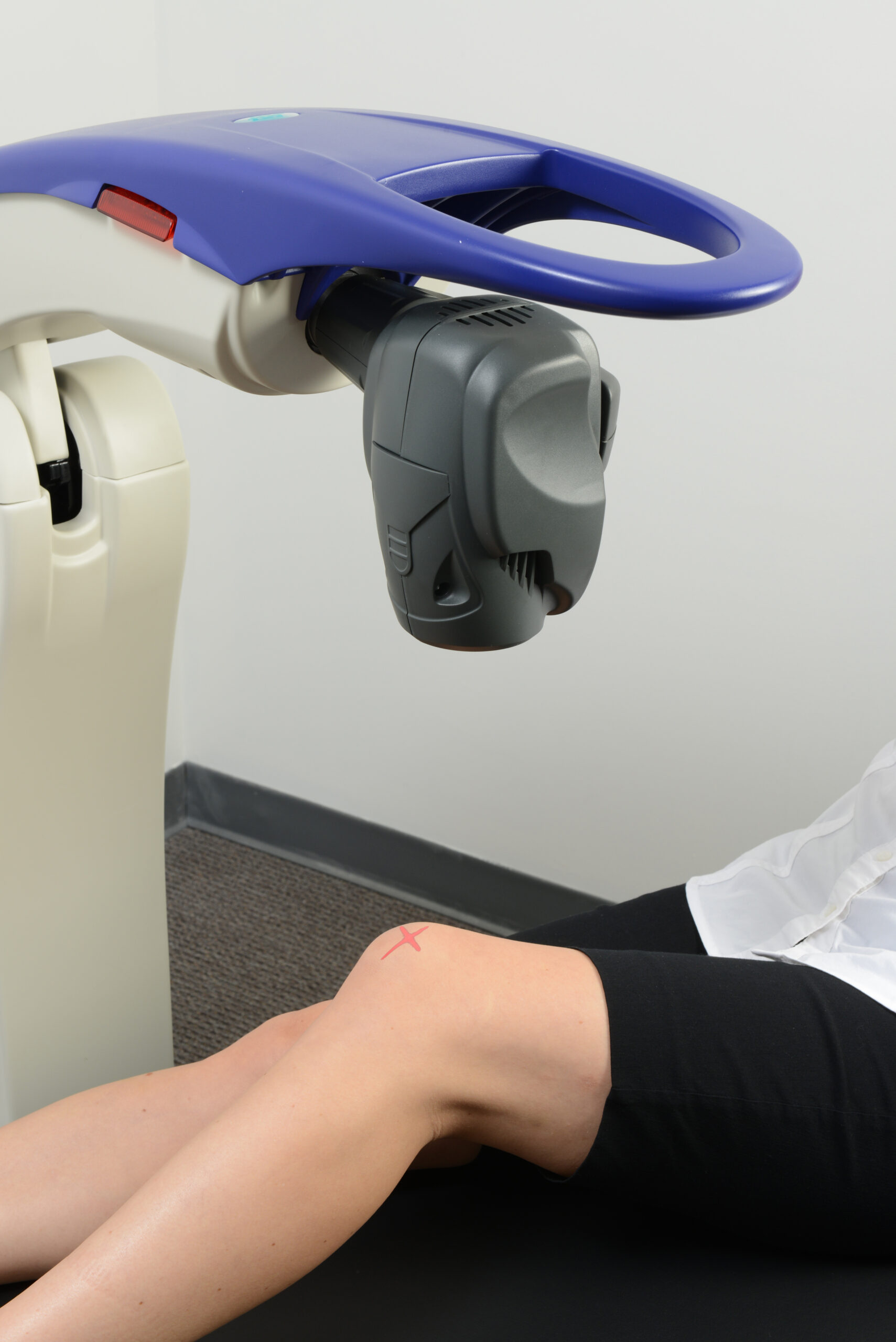 image of a person having laser therapy for their knee