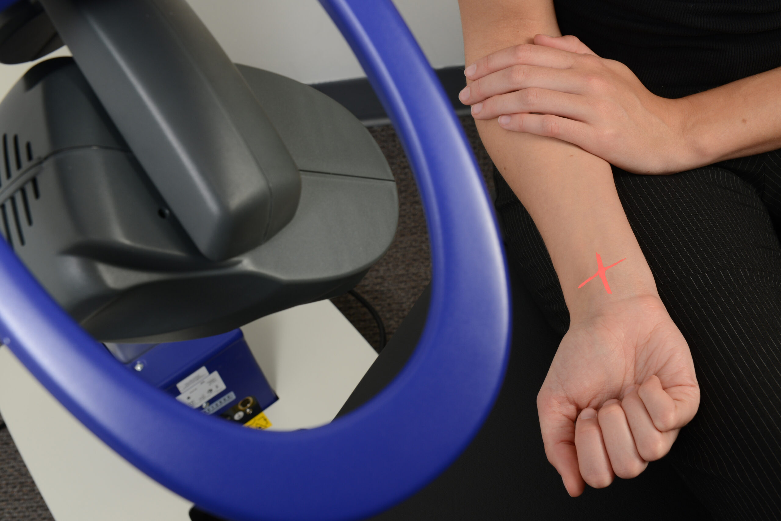 image of a person having laser therapy to their wrist